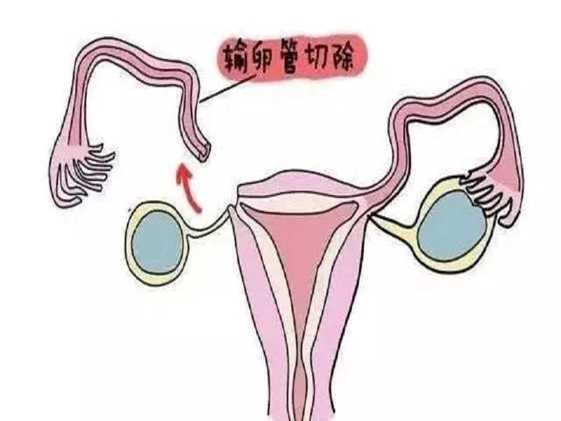 广州供卵严谨广州三甲助孕,广州供卵试管助孕哪里可以做