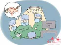 广州易生代孕网：免疫性不育的病因