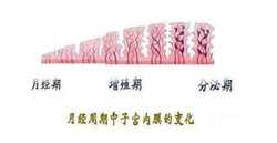 广州69助孕：精索静脉曲张并发症有哪些