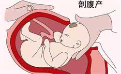 代孕是怎麼回事，试管婴儿出生后 与普通婴儿有