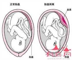 广州做试管包男孩多少钱_广州国内三代试管婴儿