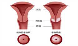 广州代孕婴儿#广州借卵合法的国家#女性顺产、剖