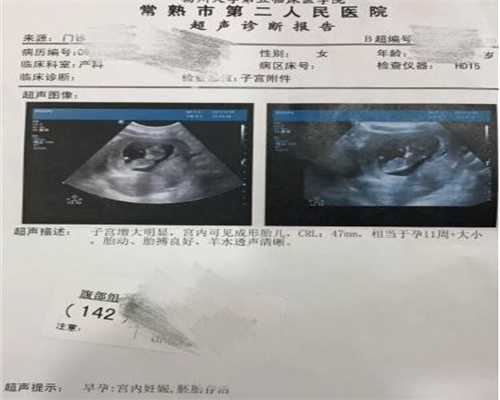 广州自然同居代孕的价格,广州试管代生孩子qq群