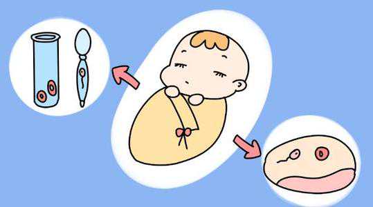 广州助孕免费咨询，广州试管婴儿助孕流程是怎样的？